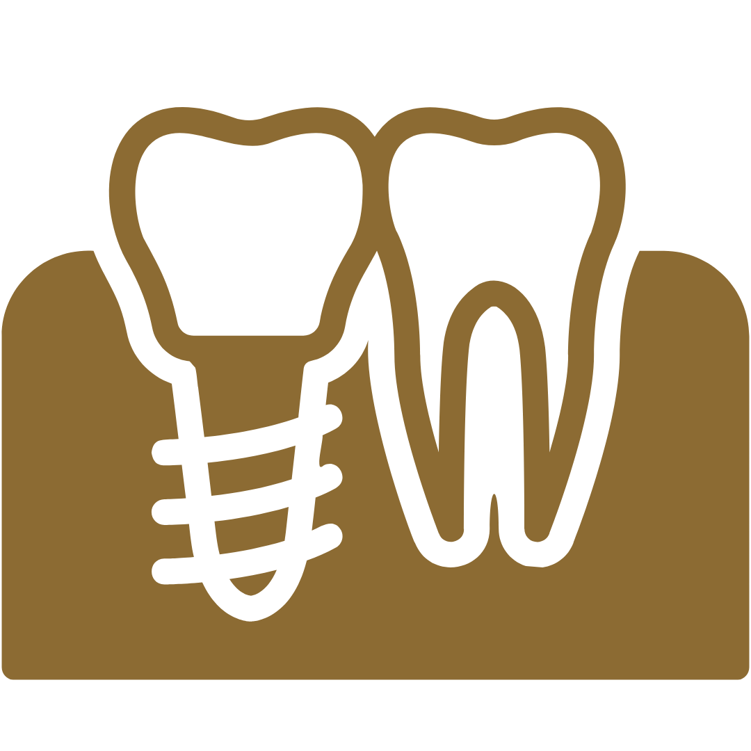 Prótese Fixa Sem Cirurgia